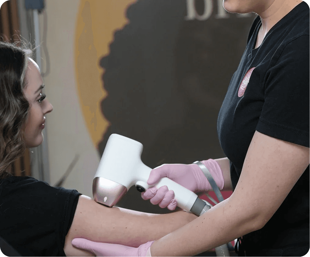 Laser hair removal treatment