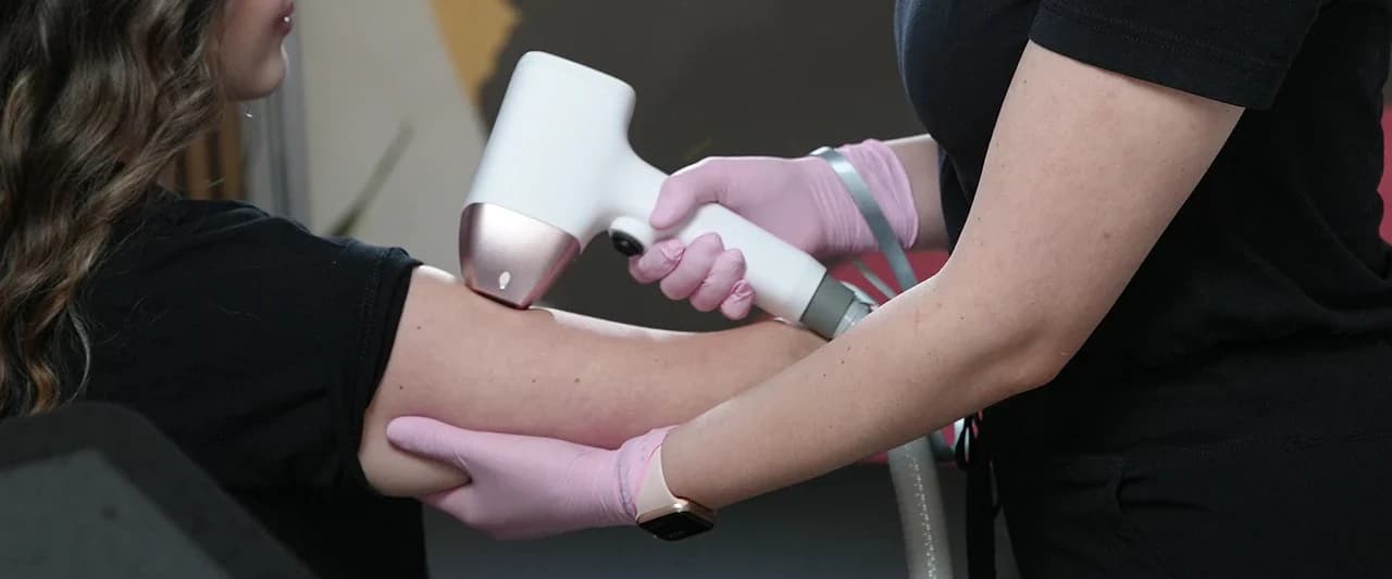 Laser hair removal step 2